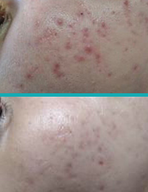 Dermatología clínica