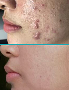 Dermatología Cosmética
