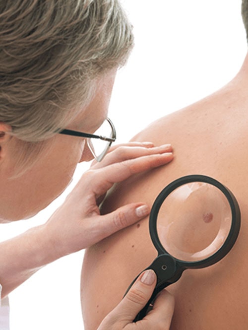 Dermatoscopia